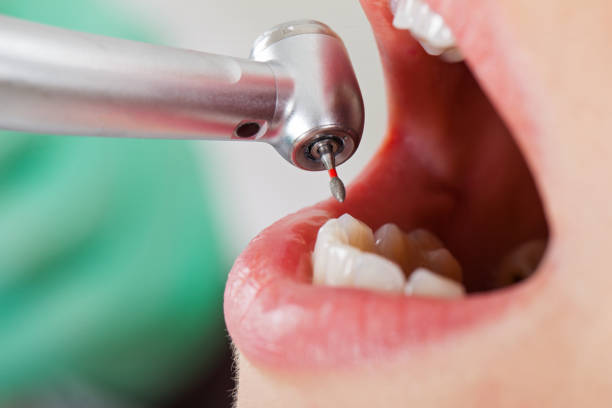 Best Urgent Tooth Repair  in Stonecrest, GA